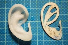 没有耳朵怎么做假耳朵？认真造假讲解人工再造耳手术！