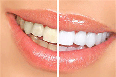 海南牙齿美容哪家牙科好?看海南牙科医院排行榜就清楚了!