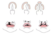 海南治疗唇腭裂比较好的医院推荐，正规靠谱技术过硬!