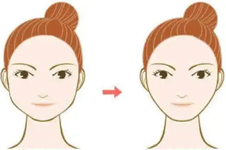 韩国面部轮廓手术优势有哪些？整形案例告诉你！