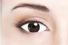 测一测哪种双眼皮手术适合你！