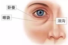 林贤超整形技术怎么样？大家都评价他的眼整形技术很不错