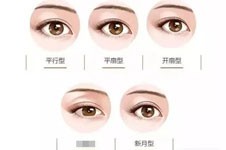 韩国THE整形做眼睛好不好？双眼皮眼修复技术评价高！