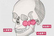 韩国DA整形医院价格表公开，眼鼻轮廓整形费用都有！