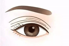 韩国眼修复好的医院中，VIBE整形眼修复技术备受认可！