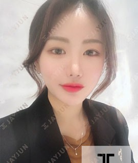 韓國(guó)jayjun整形做眼鼻+顴骨整形技術(shù)真好哇！術(shù)后簡(jiǎn)直堪比換頭