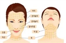 韩国俪伴整形power v面部吸脂+双下巴肌肉捆绑打造精致小V脸!