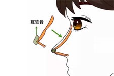 杭州李保锴做鼻子怎么样，是国内出名的鼻整形医生口碑好!