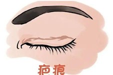 福州出名的眼修復(fù)醫(yī)生名單,薛克墘/朱剛強(qiáng)/陳明技術(shù)都不錯(cuò)!