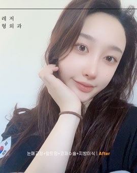 蜕变女神~韩国美舒雅整形鼻综合手术助你变成气质美女!