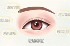 眼综合手术包括什么项目？解读眼综合和双眼皮的区别！
