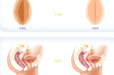 掌握济宁做私密手术的医院排名!采用3D生物束带紧缩术轻松get少女般紧致感~