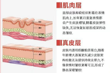 石家庄眼部抗衰医院排名前三公示:雅芳亚整形/以岭医院/庄美天整形都有自己独特的抗衰方案~