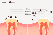 时尚美牙秘籍：一起来看看韩国牙科怎么样吧~附五家顾客口碑好的牙科地址~