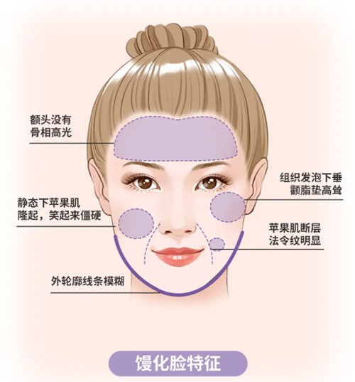 视觉冲击！王阔远实例前后对比惊艳曝光，从“馒化肿胀”到“紧致精致”的华丽蜕变