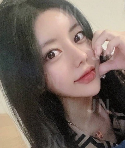 韓國(guó)JN整形金虎吉院長(zhǎng)隆鼻+面部綜合抗衰實(shí)例