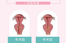 南昌私密整形去哪做？口碑好安全性高的医院还属这三家