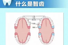 拔完智齿五六天了还是疼,是感染了吗该怎么做才能快速恢复