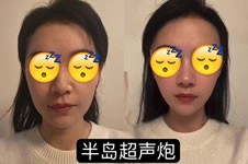 西安晶肤医疗美容医院怎么样？做完皮肤跟韩剧女主角一样