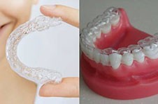 有哪个晓得重庆牙套多少钱一个?有没有晓得重庆牙套价格的?