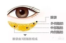 重慶哪家醫(yī)院做眼袋比較好?認準這些去眼袋好的整形醫(yī)院!