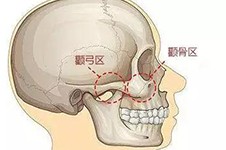 韩国哪家医院做颧骨整形好?扒皮近期热门的几家医院快看!