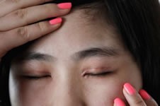 疤痕体质能做双眼皮手术吗，术后疤痕能否消除？
