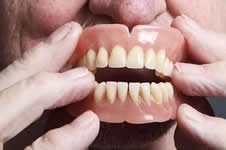 吸附性义齿和种植牙哪个好，推荐全口种植是要骗钱吗？