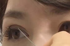点评韩国4月31日、爱婷、TS院长双眼皮技术！