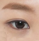 高兰得整形外科-韩国高兰得整形外科放低眼角手术前后对比照片