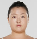 高兰得整形外科-韩国高兰得医院面部激光溶脂前后对比照片