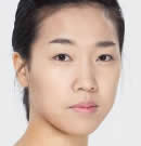 高兰得整形外科-韩国高兰得面部脂肪移植前后对比照片
