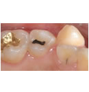 韩国多仁牙科-牙齿修复前后对比图