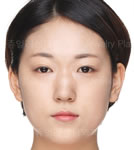 韩国珠儿丽整形外科轮廓整形案例图