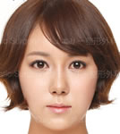 韩国珠儿丽-韩国珠儿丽整形外科轮廓整形案例图