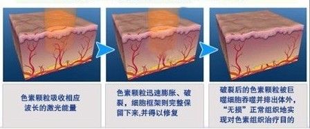 美白技能没少用 为啥皮肤更黑了？