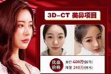 韩国优雅人整形医院华人福利大放送，美鼻降至249万韩币！