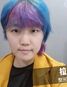 韩国拉本整形医院男性鼻整形手术分享
