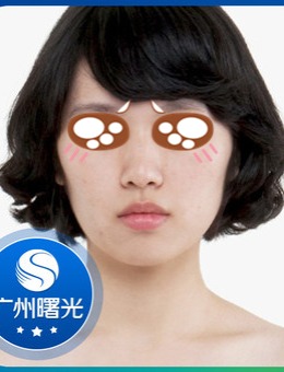 广州曙光谁做鼻子好？看看我找王旭明主任做膨体隆鼻的案例吧！