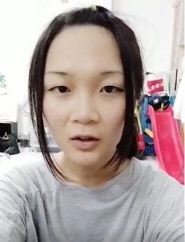 韩国艺颂嗓音中心医院嗓音女性化手术视频+图文效果分享