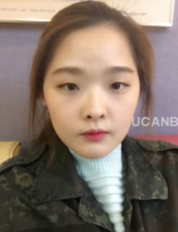 -韩国Ucanb整形外科眼鼻整形真人案例展示！