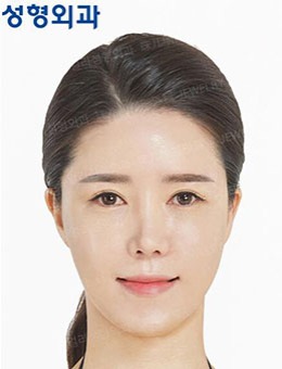 面部抗初老该怎么整形，韩国珠儿丽面部提升手术效果还不错！_术后