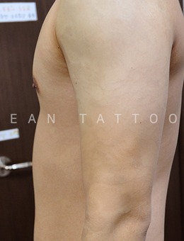 韩国科琳挞图手臂纹身洗完恢复正常图片