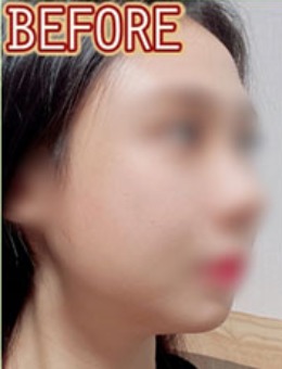韩国dr朵整形面部整形前后对比图