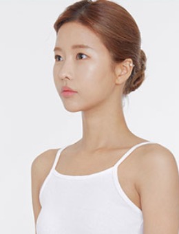 韩国dr朵女生C罩杯隆胸前后对比照