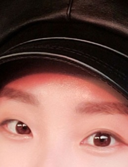 韩国yellow眼睛一单一双整形手术对比照_术前