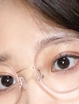 韩国yellow整形自然流畅双眼皮手术图