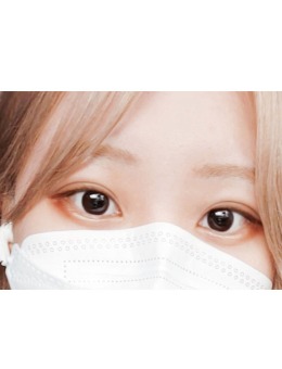 韩国yellow埋线双眼皮手术对比照片