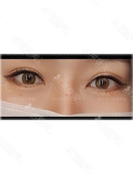 -  韩国修复眼睛好的的医院推荐现代美学整形，看改变就能知道实力！