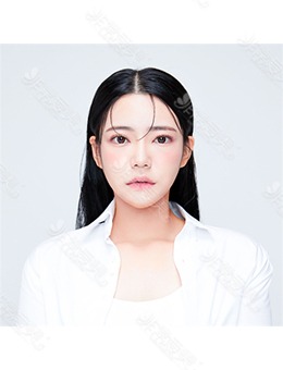 韩国ARC整形外科眼综合+鼻综合+轮廓三件套前后照片公开！_术后